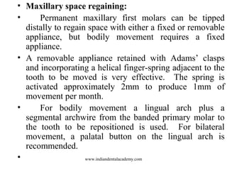 • Maxillary space regaining:
• Permanent maxillary first molars can be tipped
distally to regain space with either a fixed or removable
appliance, but bodily movement requires a fixed
appliance.
• A removable appliance retained with Adams’ clasps
and incorporating a helical finger-spring adjacent to the
tooth to be moved is very effective. The spring is
activated approximately 2mm to produce 1mm of
movement per month.
• For bodily movement a lingual arch plus a
segmental archwire from the banded primary molar to
the tooth to be repositioned is used. For bilateral
movement, a palatal button on the lingual arch is
recommended.
• www.indiandentalacademy.com
 