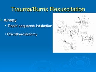 Trauma/Burns Resuscitation Airway Rapid sequence intubation Cricothyroidotomy 