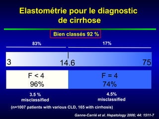 14.6
Elastométrie pour le diagnosticElastométrie pour le diagnostic
de cirrhosede cirrhose
3 75
Bien classés 92 %
Ganne-Carrié et al. Hepatology 2006; 44: 1511-7
F = 4
74%
4.5%
misclassified
17%
3.5 %
misclassified
F < 4
96%
83%
(n=1007 patients with various CLD, 165 with cirrhosis)
 