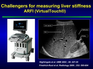 Friedrich-Rust et al. Radiology 2009 ; 252: 595-604
Challengers for measuring liver stiffnessChallengers for measuring liver stiffness
ARFI (VirtualTouch®)ARFI (VirtualTouch®)))
Nightingale et al. UMB 2002 ; 28: 227-35
 