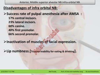 Success rate of pulpal anesthesia after AMSA :
17% central incisors.
23% lateral incisors.
60% canine.
40% first premolar.
66% second premolar.
Inactivation of muscles of facial expression.
Lip numbness.[Trauma-inability for eating & drinking].
Disadvantages of infra orbital NB:
2/22/2017 7:17 PM Atef Fouda, Prof. of Oral and maxillofac.Surg. & Local Anesthesia.
Anterior, Middle superior alveolar NB.Infra-orbital NB.
 