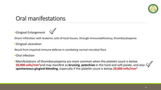 Oral manifestations
Gingival Enlargement
Direct infiltration with leukemic cells of local tissues, through immunodeficiency, thrombocytopenia
Gingival ulceration
Result from impaired immune defense in combating normal microbial flora
Oral infection
Manifestations of thrombocytopenia are more common when the platelet count is below
50,000 cells/mm3and may manifest as bruising, petechiae in the hard and soft palate, and also
spontaneous gingival bleeding, especially if the platelet count is below 20,000 cells/mm3
13
 