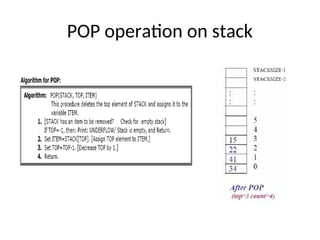 POP operation on stack
 