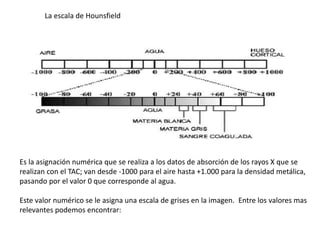 Es la asignación numérica que se realiza a los datos de absorción de los rayos X que se
realizan con el TAC; van desde -1000 para el aire hasta +1.000 para la densidad metálica,
pasando por el valor 0 que corresponde al agua.
Este valor numérico se le asigna una escala de grises en la imagen. Entre los valores mas
relevantes podemos encontrar:
La escala de Hounsfield
 