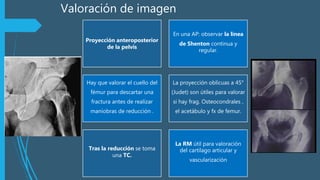 Valoración de imagen
Proyección anteroposterior
de la pelvis
En una AP: observar la línea
de Shenton continua y
regular.
Hay que valorar el cuello del
fémur para descartar una
fractura antes de realizar
maniobras de reducción .
La proyección oblicuas a 45°
(Judet) son útiles para valorar
si hay frag. Osteocondrales ,
el acetábulo y fx de femur.
Tras la reducción se toma
una TC.
La RM útil para valoración
del cartilago articular y
vascularización
 