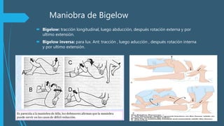 Maniobra de Bigelow
 Bigelow: tracción longitudinal, luego abducción, después rotación externa y por
ultimo extensión.
 Bigelow inversa: para lux. Ant: tracción , luego aducción , después rotación interna
y por ultimo extensión.
 