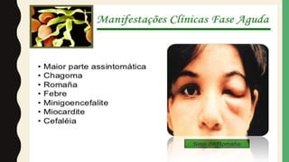Malária