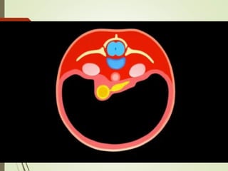 Malrotacion