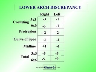 Right Left
3x3
6x6
Crowding
Protrusion
Curve of Spee
Midline
3x3
Total
6x6
LOWER ARCH DISCREPANCY
Chart 2
-3
-3
-1
-1
-2 -2
-1 -1
+1 -1
-5 -5
-5 -5
www.indiandentalacademy.com
 