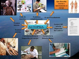 AUTOPSIA 
Que Describe 
externa e 
internamente el 
cuerpo 
Es un Procedimiento 
Lectura del 
acta de 
inspección 
Del cadáver 
Lectura de la 
historia clínica. 
Toma de 
muestra. 
Corroboración de la 
Inspección del cuerpo. 
Examen 
interno. 
Examen 
externo. 
Exámenes 
complementario. 
 