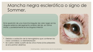 Mancha negra esclerótica o signo de
Sommer.
Es la aparición de una mancha irregular de color negro en los
ángulos externos del segmento anterior del ojo, en forma
inicial, y posteriormente en los ángulos internos
• Debida a oxidación de la hemoglobina que contienen los
vasos coroideos y a deshidratación
• Se vuelve visible a partir de las cinco horas (si los párpados
se encuentran abiertos)
Grandini gonzález, J. Medicina forence. 3ed. Ed. ManualModerno.
 