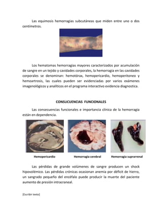 [Escribir texto]
Las equimosis hemorragias subcutáneas que miden entre uno o dos
centímetros.
Los hematomas hemorragias mayores caracterizados por acumulación
de sangre en un tejido y cavidades corporales, la hemorragia en las cavidades
corporales se denominan: hemotórax, hemopericardio, hemoperitoneo y
hemoartrosis, las cuales pueden ser evidenciadas por varios exámenes
imagenológicos y analíticos en el programa interactivo evidencia diagnostica.
CONSUCUENCIAS FUNCIONALES
Las consecuencias funcionales e importancia clínica de la hemorragia
están en dependencia.
Las pérdidas de grande volúmenes de sangre producen un shock
hipovolémico. Las pérdidas crónicas ocasionan anemia por déficit de hierro,
un sangrado pequeño del encéfalo puede producir la muerte del paciente
aumento de presión intracraneal.
Hemopericardio Hemorragia cerebral Hemorragia suprarrenal
 
