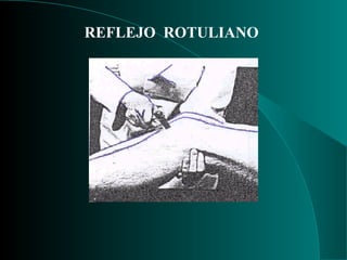 REFLEJO  ROTULIANO 