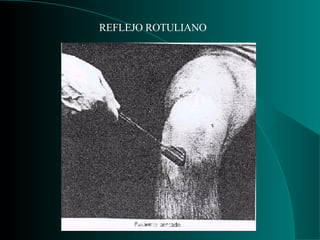 REFLEJO ROTULIANO 