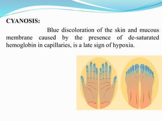 CYANOSIS:
Blue discoloration of the skin and mucous
membrane caused by the presence of de-saturated
hemoglobin in capillaries, is a late sign of hypoxia.
 