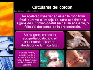 Desaceleraciones variables en la monitoría
fetal, durante el trabajo de parto asociadas a
signos de sufrimiento fetal sin causa aparente, o
falta del descenso de la presentación.
Se diagnóstica con la
ecografía obstétrica, al
observarse el cordón
alrededor de la nuca fetal.
Cuando no hay
encajamiento o
existe sufrimiento
fetal el tratamiento
es la intervención
cesárea.
 