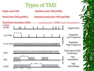 Types of TMS
Single-pulse TMS Repetitive pulse TMS (rTMS)
Paired pulse TMS (ppTMS ) Repeated paired pulse TMS (rppTMS)
Theta Burst Stimulation (TBS)--------continuously (cTBS) and intermittent
(iTBS)
 