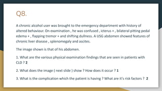 Q8.
A chronic alcohol user was brought to the emergency department with history of
altered behaviour. On examination , he was confused , icterus + , bilateral pitting pedal
edema + , flapping tremor + and shifting dullness. A USG abdomen showed features of
chronic liver disease , splenomegaly and ascites.
The image shown is that of his abdomen.
1. What are the various physical examination findings that are seen in patients with
CLD ? 2
2. What does the image ( next slide ) show ? How does it occur ? 1
3. What is the complication which the patient is having ? What are it's risk factors ? 2
 