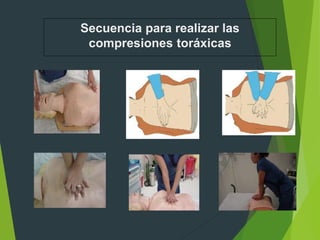 Secuencia para realizar las
compresiones toráxicas
 