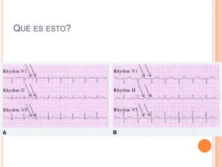 QUÉ ES ESTO?
 