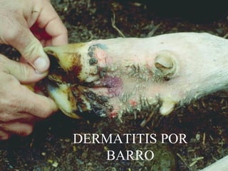 55
DERMATITIS POR
BARRO
 
