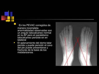  En los PEVAC corregidos de
manera incompleta
anormalidades observadas son
un angulo talocalcaneo normal
en la AP pero el paralelismo
talocalcaneo persiste en en
lalateral
 El aplanamiento del domo talar
periste y puede persistir el cavo
del pie puede presentarse y
fracturas de la base de los
metatarsianos
 