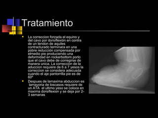 Tratamiento
 La correccion forzada el equino y
del cavo por dorsiflexión en contra
de un tendon de aquiles
contracturado terminara en una
pobre reducción compensada por
elmedio pie produciendo una
deformidad en rockerbottom porlo
que el cavo debe de corregirse de
manera unica. La correccion de la
aduccion requiere de 6 a 7 yesos la
correccion se considera adecusda
cuando el aje pantorrilla pie es de
60º
 Despues de lamaxima abduccion es
lamayoria de loscasos requiere de
un ATA el ultimo yeso se coloca en
maxima dorsiflexion y se deja por 2-
3 semanas
 