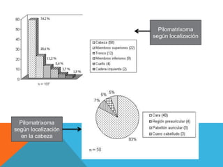 Pilomatrixoma
según localización
Pilomatrixoma
según localización
en la cabeza
 