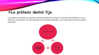 La prótesis dental fija
La prótesis dental fija es cualquier prótesis dental que se fija en el estudio del dentista y no se
retira por el paciente. Es más parecida a los dientes naturales y se cuida igual como los dientes
naturales.
Los puentes Dentales
Prótesis fijas
sobre dientes
naturales,
Prótesis fijas
sobre implantes
Dentales
 