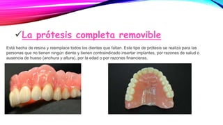 La prótesis completa removible
Está hecha de resina y reemplace todos los dientes que faltan. Este tipo de prótesis se realiza para las
personas que no tienen ningún diente y tienen contraindicado insertar implantes, por razones de salud o
ausencia de hueso (anchura y altura), por la edad o por razones financieras.
 