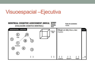 Visuoespacial –Ejecutiva
 