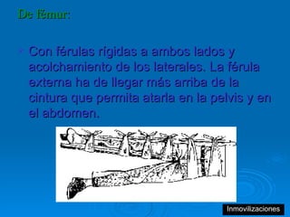 De fémur:   Con férulas rígidas a ambos lados y acolchamiento de los laterales. La férula externa ha de llegar más arriba de la cintura que permita atarla en la pelvis y en el abdomen.  Inmovilizaciones 