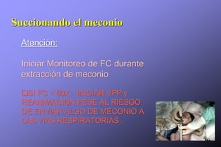Succionando el meconio
Atención:
Iniciar Monitoreo de FC durante
extracción de meconio
SI FC < 60x’: INICIAR VPP y
REANIMACIÓN PESE AL RIESGO
DE ENVIAR ALGO DE MECONIO A
LAS VIAS RESPIRATORIAS .
 