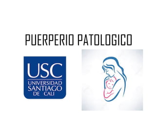 PUERPERIO PATOLOGICO
 