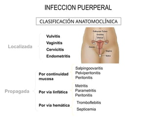 CLASIFICACIÓN ANATOMOCLÍNICA
Localizada
Propagada
Vulvitis
Vaginitis
Cervicitis
Endometritis
Por continuidad
mucosa
Por vía linfática
Por vía hemática
Salpingoovaritis
Pelviperitonitis
Peritonitis
Metritis
Parametritis
Peritonitis
Tromboflebitis
Septicemia
INFECCION PUERPERAL
 