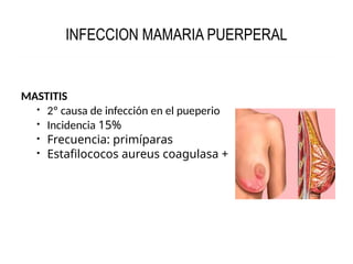INFECCION MAMARIA PUERPERAL
MASTITIS
 2º causa de infección en el pueperio
 Incidencia 15%
 Frecuencia: primíparas
 Estafilococos aureus coagulasa +
 