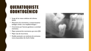 QUERATOQUISTE
ODONTOGÉNICO
• Surge de los restos celuláres de la lámina
dental.
• Mecanismo de crecimiento y comportamiento
biológico simila a una neoplasia benigna. *
• Crecimiento por factores genéticos o actividad
enzimatica.
• Mayor potencial de crecimiento que otros QO.
• Mayor tasa de recurrencia.
• Posible asociación con sindrome de carcinoma
nevico basocelular. (Sx Gorlin Goltz)
 