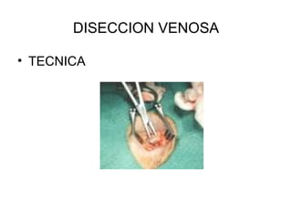 DISECCION VENOSA TECNICA 