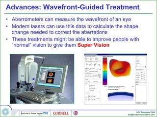 Advances: Wavefront-Guided Treatment Aberrometers can measure the wavefront of an eye Modern lasers can use this data to calculate the shape change needed to correct the aberrations These treatments might be able to improve people with “normal” vision to give them  Super Vision 