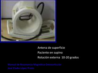 RM
Antena de superficie
Paciente en supino
Rotación externa 10-20 grados
Manual de Resonancia Magnética Osteoarticular
José Eladio López Prieto
 