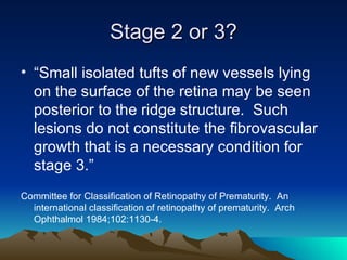 Stage 2 or 3? “ Small isolated tufts of new vessels lying on the surface of the retina may be seen posterior to the ridge structure.  Such lesions do not constitute the fibrovascular growth that is a necessary condition for stage 3.” Committee for Classification of Retinopathy of Prematurity.  An international classification of retinopathy of prematurity.  Arch Ophthalmol 1984;102:1130-4. 