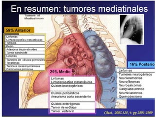 SINDROME MEDIASTINAL