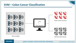 DATA SCIENCE CERTIFICATION TRAINING www.edureka.co/data-science
SVM – Colon Cancer Classification
SVM Algorithm
Gene samples
Colon cancer tumours
Normal colon tissues
 