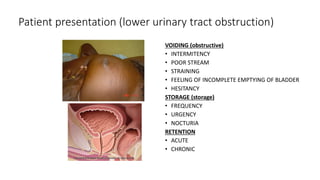 Patient presentation (lower urinary tract obstruction)
VOIDING (obstructive)
• INTERMITENCY
• POOR STREAM
• STRAINING
• FEELING OF INCOMPLETE EMPTYING OF BLADDER
• HESITANCY
STORAGE (storage)
• FREQUENCY
• URGENCY
• NOCTURIA
RETENTION
• ACUTE
• CHRONIC
 