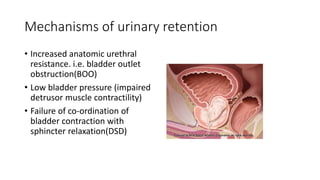 Mechanisms of urinary retention
• Increased anatomic urethral
resistance. i.e. bladder outlet
obstruction(BOO)
• Low bladder pressure (impaired
detrusor muscle contractility)
• Failure of co-ordination of
bladder contraction with
sphincter relaxation(DSD)
 