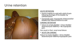 Urine retention
ACUTE RETENTION
• Painful inability to void with relief of pain
following drainage of the bladder by
catheterization
• Suprapubic pain +Suprapubic distension(full
bladder350-500mls)+failure to void
CHRONIC RETENTION
• Failure to empty bladder + Gross bladder
distention(over 800mls) + No Suprapubic
pain.
Can result in Post -renal renal failure
• ACUTE ON CHRONIC
Failure to empty bladder + Gross bladder
distention(over 800mls)+Suprapubic pain
 