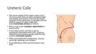 Ureteric Colic
• The nerve supply of the upper ureter is by T
10; hence pain starts at costo-vertebral angle
and radiate around the trunk into the lower
quadrant of the abdomen, or possibly into the
anterior aspect of upper thigh and
testicle(simulates torsion) or labium
• Pain in mid-ureter simulates appendicitis or
diverticulitis.
• In the distal ureter ,the Pain is felt as
suprapubic discomfort with LUTS (urgency,
frequency) and radiates along urethra to tip
of penis.(simulates cystitis)
• Often associated with restlessness, nausea,
vomiting, sweating, and collapse.
• Associated fever chills and haematuria may
exist
 