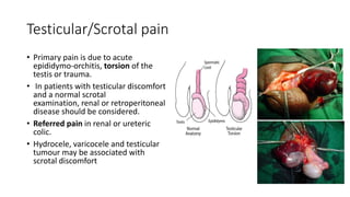 Testicular/Scrotal pain
• Primary pain is due to acute
epididymo-orchitis, torsion of the
testis or trauma.
• In patients with testicular discomfort
and a normal scrotal
examination, renal or retroperitoneal
disease should be considered.
• Referred pain in renal or ureteric
colic.
• Hydrocele, varicocele and testicular
tumour may be associated with
scrotal discomfort
 