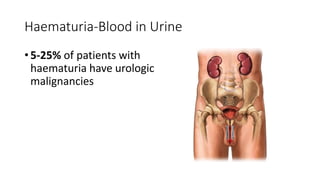 Haematuria-Blood in Urine
• 5-25% of patients with
haematuria have urologic
malignancies
 