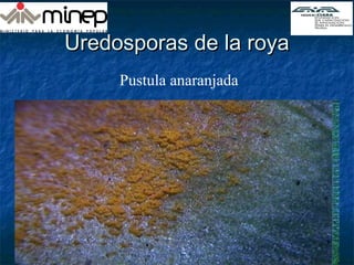 Uredosporas de la royaUredosporas de la roya
Pustula anaranjada
 